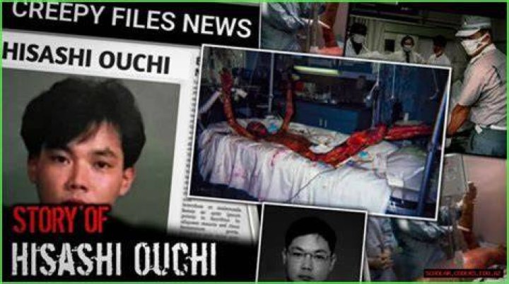 A Journey Through The Hisashi Ouchi Hospital Photos