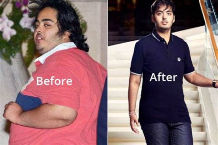 Anant Ambani Extreme Weight Loss This Diet Helped Mukesh Ambani’s Son