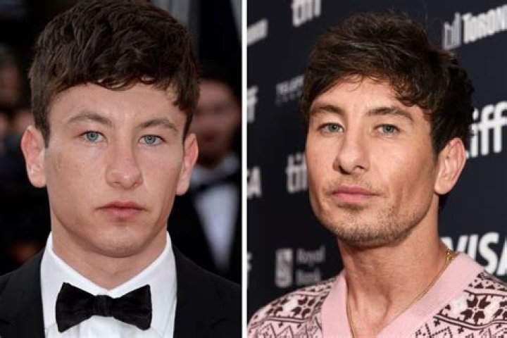 Barry Keoghan&rsquo;s Plastic Surgery plastic surgery for jaw reconstruction