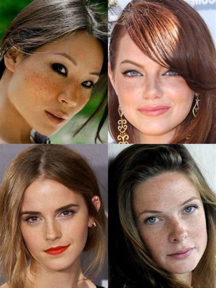 Celebrities With Freckles These Photos Will Make You Love Your