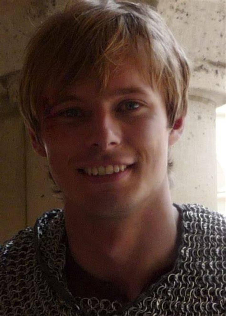 Did Bradley James Fix his Teeth? Why that's bad HubPages