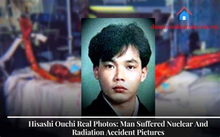 Discover The Untold Story Of Hisashi Ouchi Real Photos