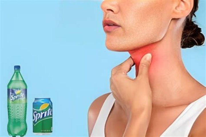 Does Sprite Help Soothe a Sore Throat? Essential Guide Foods Guy