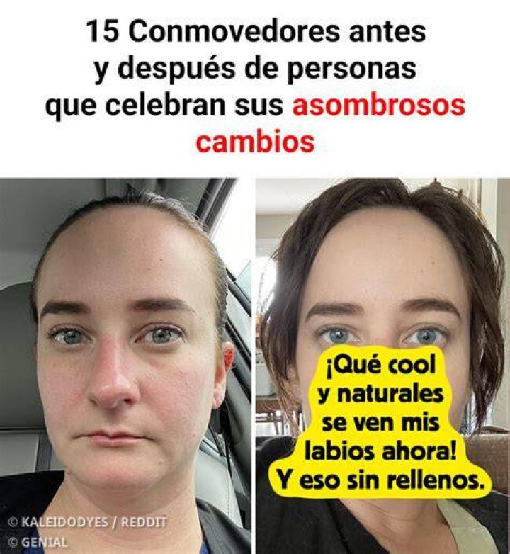 El asombroso antes y despu&eacute;s de Anya Chalotra, la nueva Yennefer de The