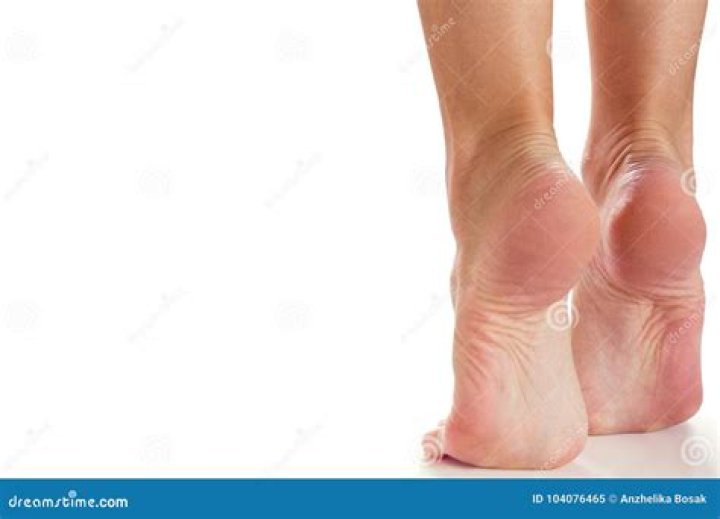 Feet stand on toes stock image. Image of heel, stand 104076465