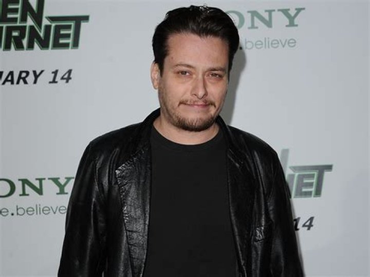 Former child star Edward Furlong reveals new teeth&hellip;