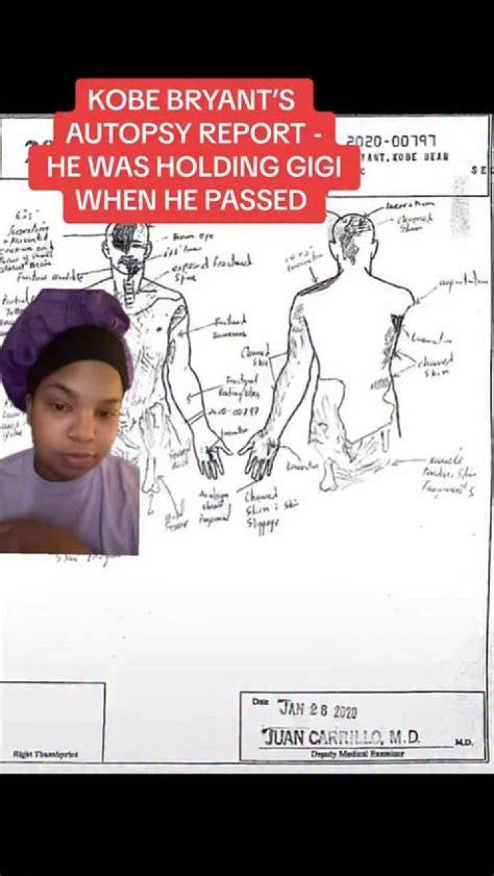 Gidi Bryant Autopsy Pictures Sketches Leak Online