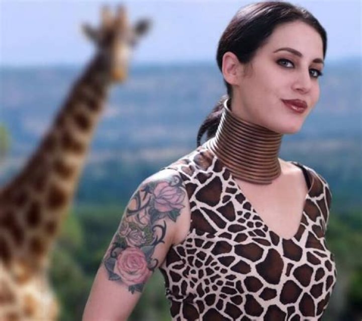 Giraffe Woman Finally Takes Her Rings Off After Five Years. Try Not to