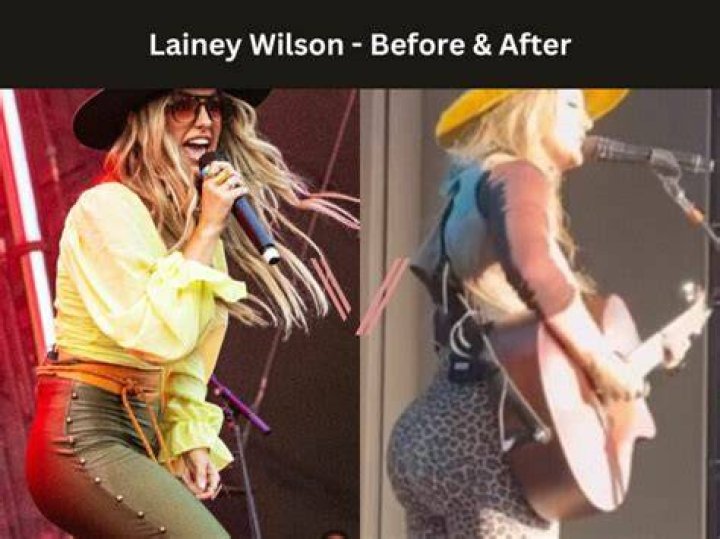 Has Lainey Wilson Received BBL? Reddit Users Discuss Her Plastic Surgery!
