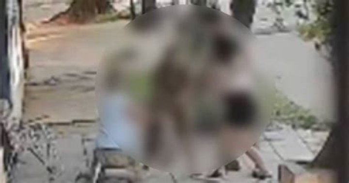 Hombre muere deshebrado su agonía duró 83 días FOTOS El Mañana de