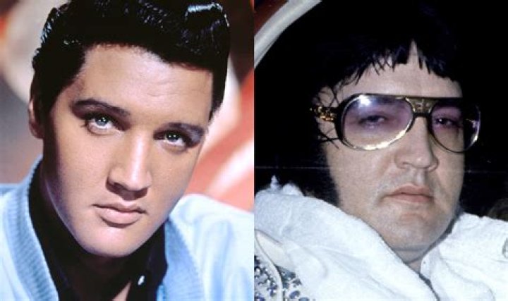 How Did Elvis Presley Die?