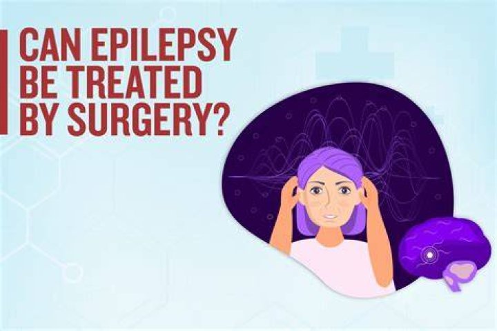 How Epilepsy Is Treated (2023)