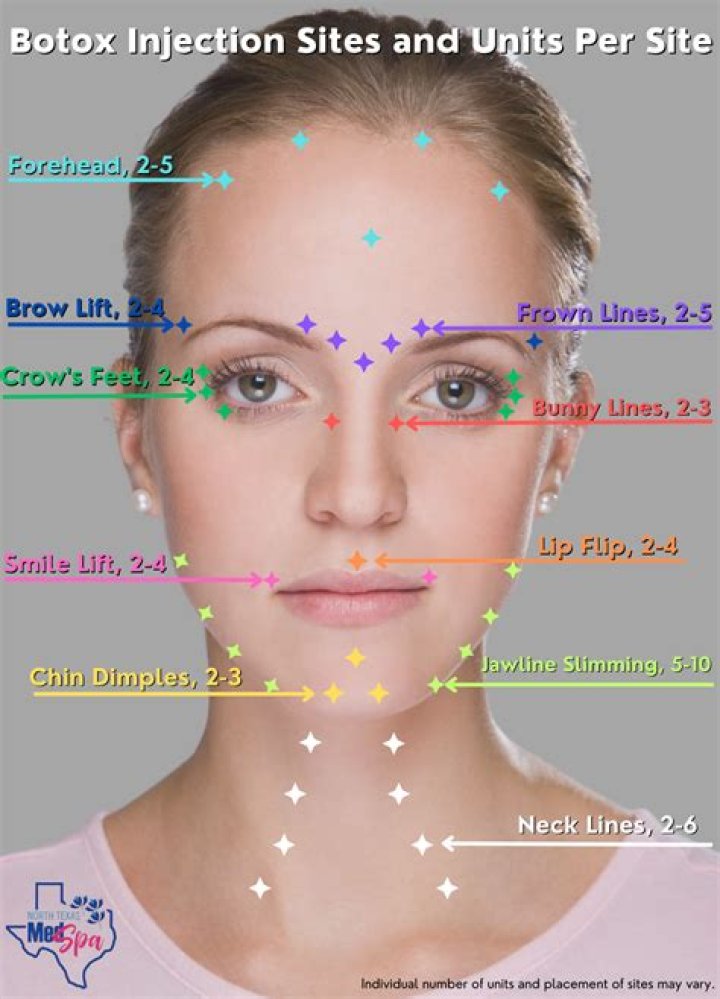 How Much Botox Do I Need tour bous