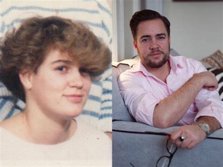 Ian Harvie Before Surgery And As A Child Family And Wikipedia Bio