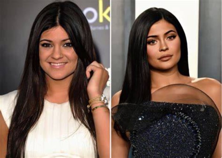 Kylie Jenner before and after her jawdropping transformation pics