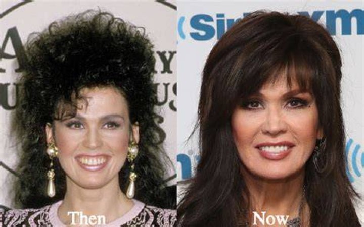 Marie Osmond Plastic Surgery: How She Maintains Her Youthful Looks 1 Marie Osmond Plastic Surgery: How She Maintains Her Youthful Looks