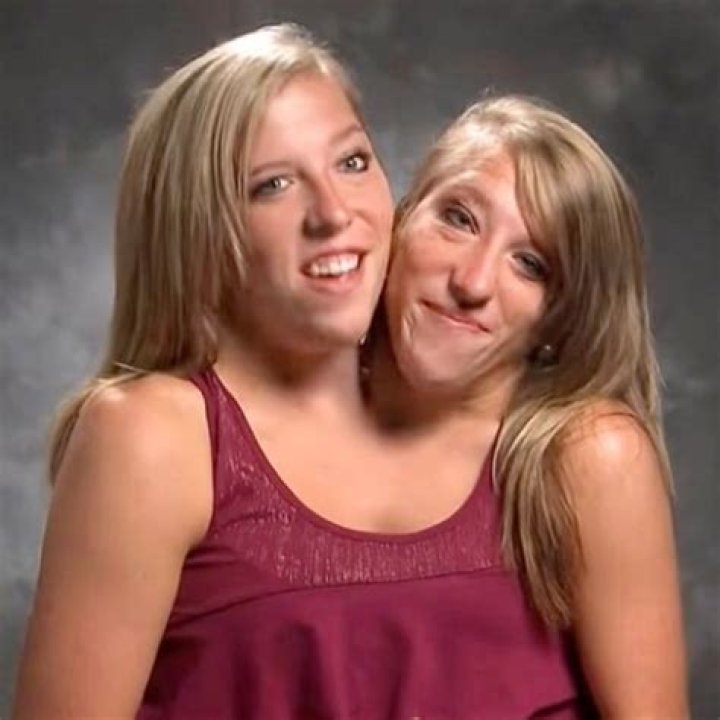 New details of conjoined twins Abby and Brittany Hensel’s wedding day