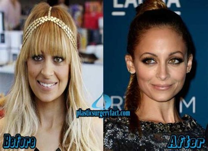 Nicole Richie Bikini Photos: Before & After