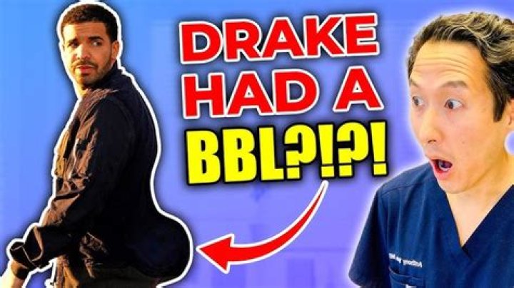 Plastic Surgeon Trolls Drake Over Alleged Liposuction!! Media Take Out