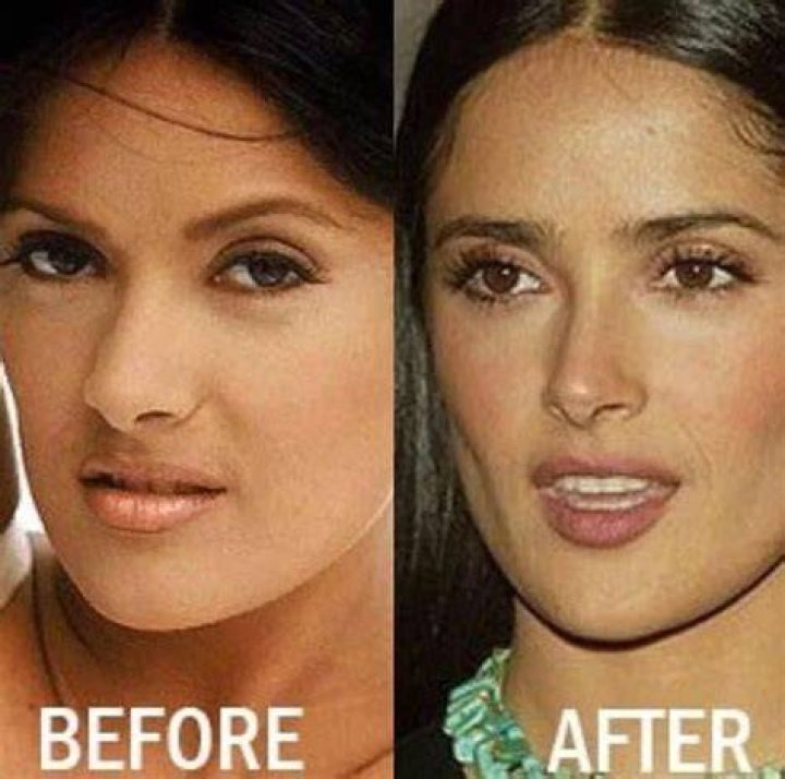 Salma Hayek Plastic Surgery Before and After