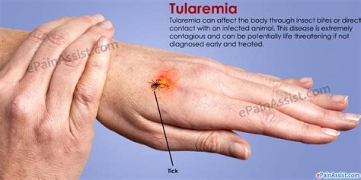 Tularemia in Horses Symptoms, Causes, Diagnosis, Treatment, Recovery