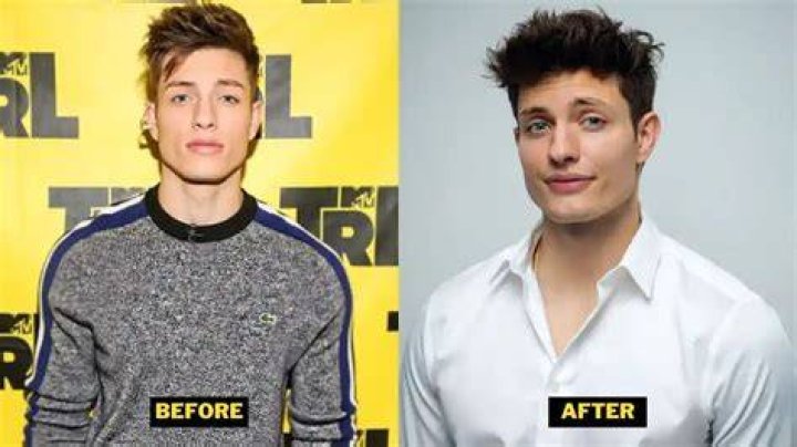 Unveiling Matt Rife's Transformation: Before The "Glow Up"