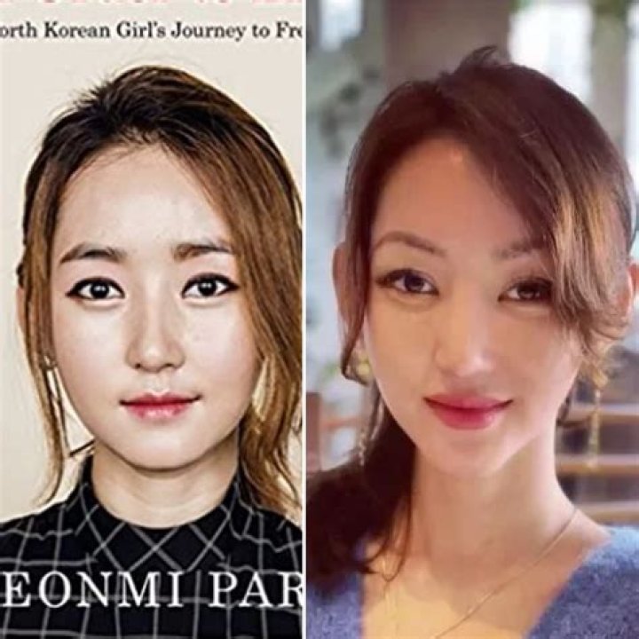 Unveiling Yeonmi Park's Surgery: Uncovering Truths And Insights