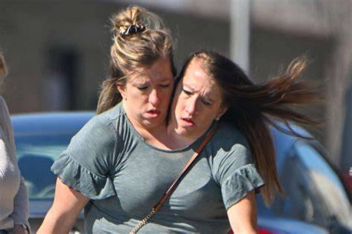 What Conjoined Twins Abby And Brittany Hensel Look Like Today (With