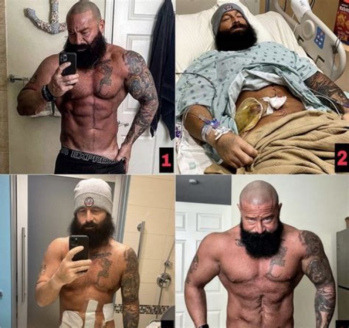 What Happened To Robert Frank? Illness Health And Surgery – Is He Sick? ·