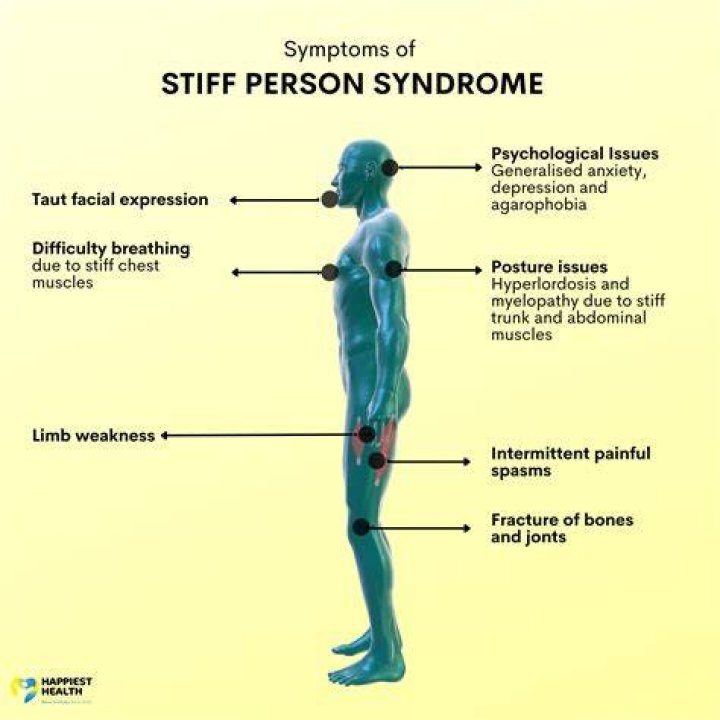 What Is Stiff Person Syndrome? Celine Dion Diagnosed With Rare and