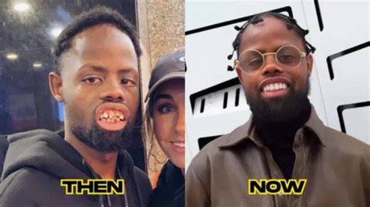 What Really Happened To Welven Da Great, Aka Deez Nuts Guy? Is The Deez