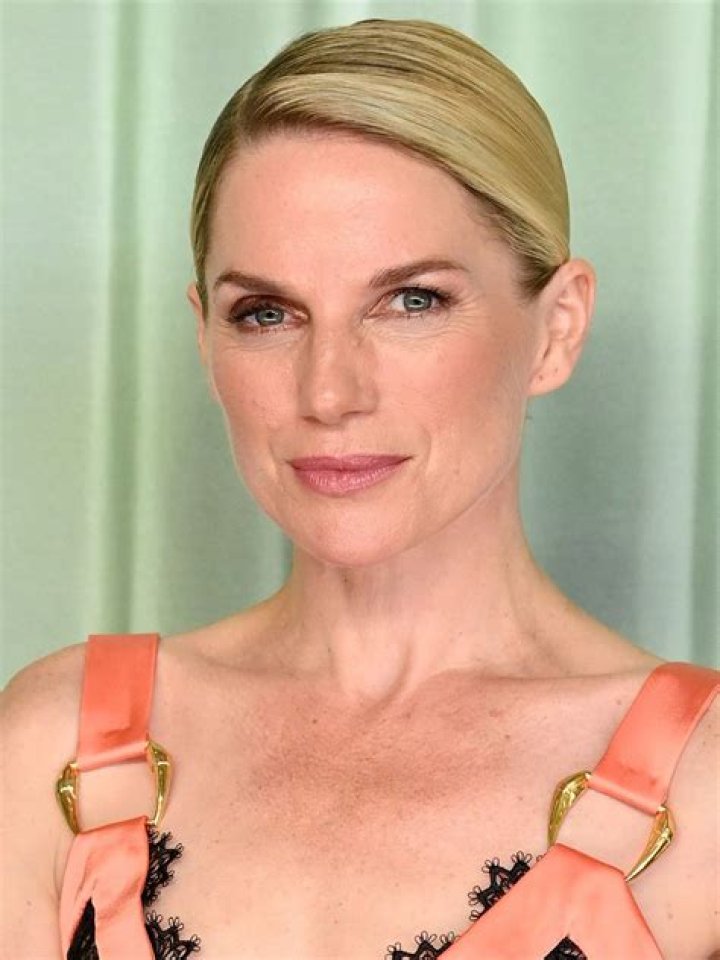 Why Do Fans Think Eva Birthistle Have A Glass Eye? Update On Her Eye Injury And Surgery Rumors ·