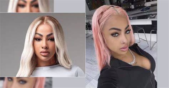 Yailin se somete a una nueva cirug&iacute;a, &iexcl;y esta vez en el rostro!